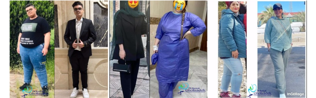 بعد از بای پس معده چقدر وزن کم میکنیم؟ دیدگاه دکتر قلی زاده