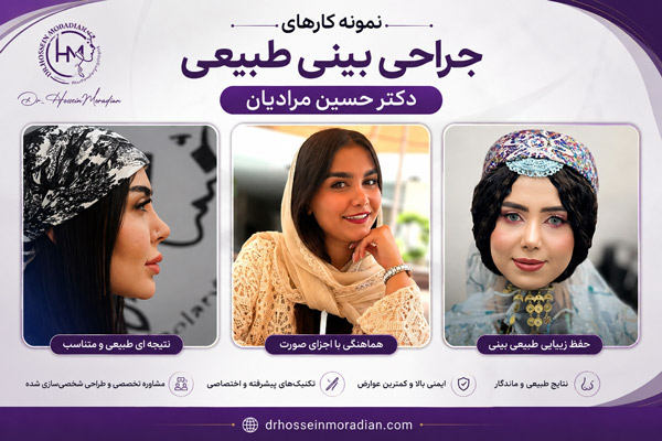 دکتر حسین مرادیان؛ انتخابی آگاهانه برای جراحی بینی در شیراز