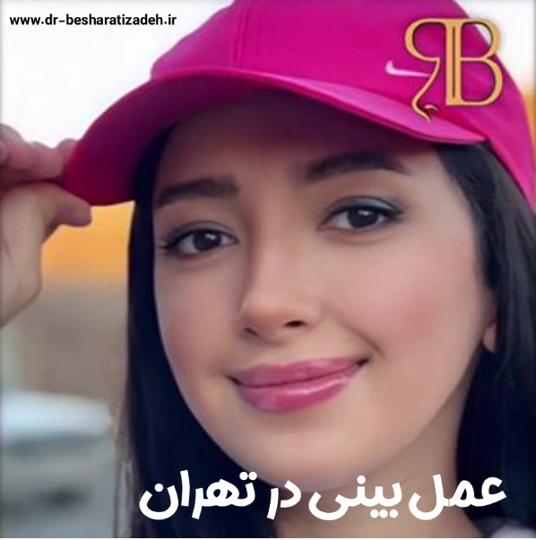 راهنمای کامل متقاضیان جراحی بینی در تهران