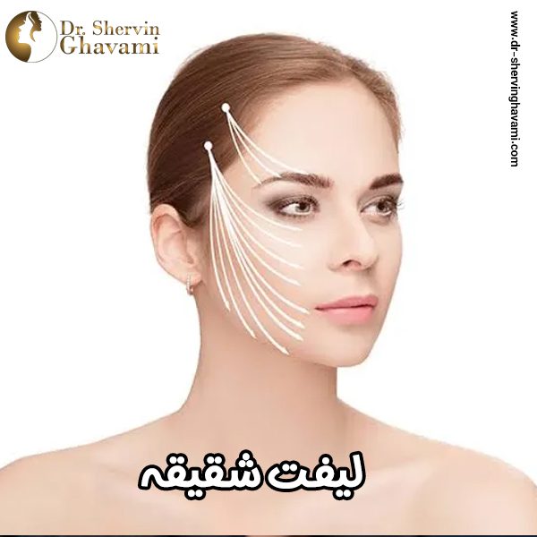 قبل از لیفت شقیقه این نکات مهم را بدانید