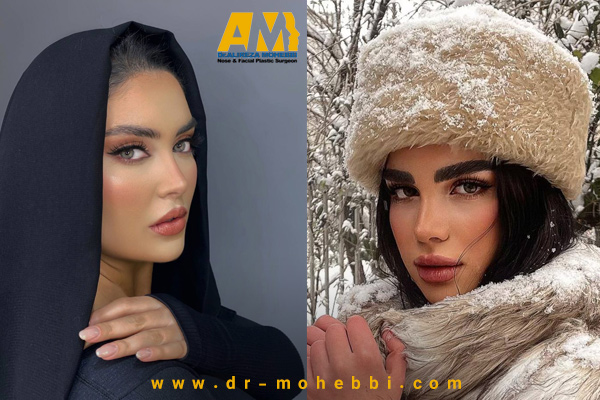 جراحی بینی در تهران با دکتر علیرضا محبی .