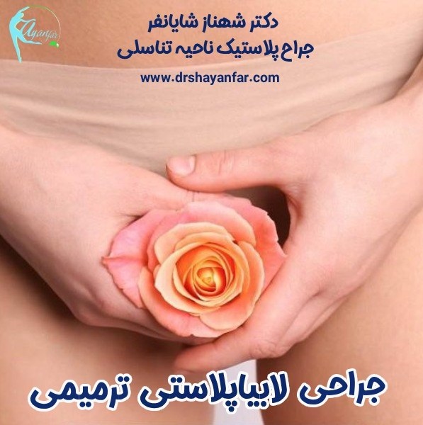 جراحی ترمیمی لابیاپلاستی