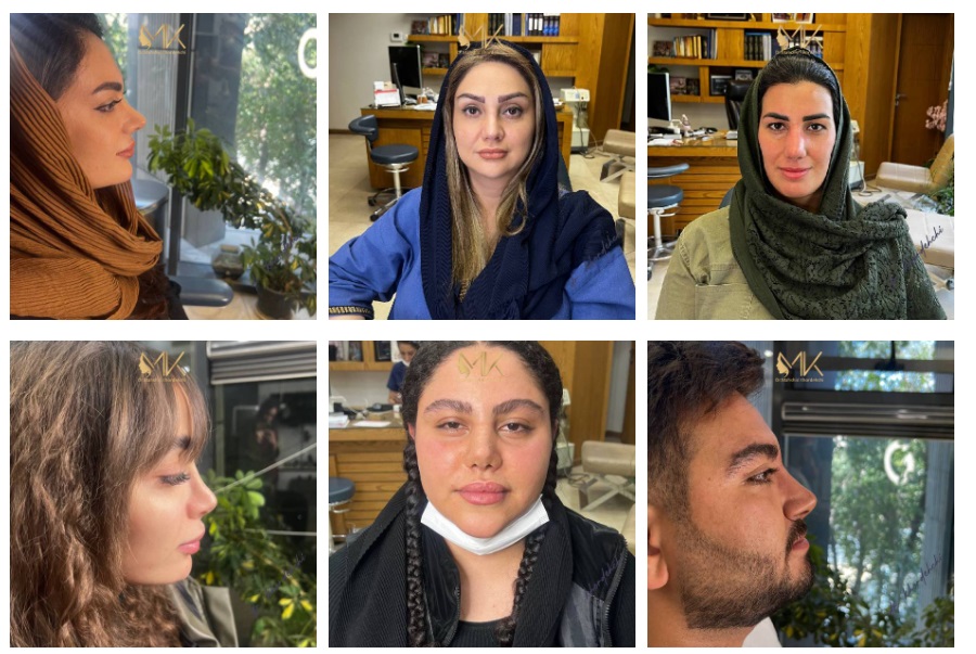 چطور جراح بینی مناسب در اصفهان را انتخاب کنیم؟ 3